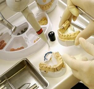Clínica Dental Ylenia Catala molde de dentadura